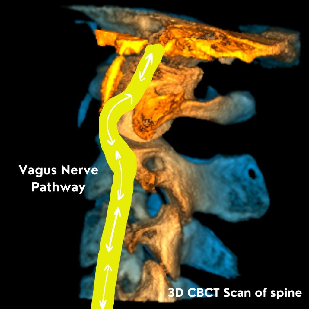 Vagus Nerve